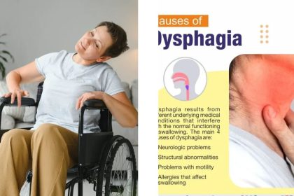 pavatalgia disease